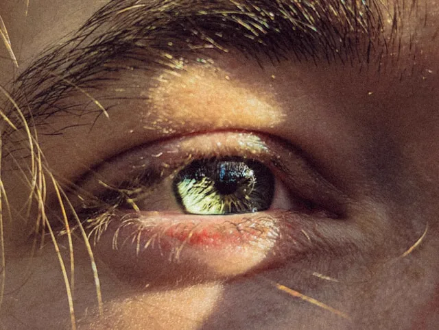 Close-up of a patient’s eye representing a LASIK consultation with Dr. Roxanna Gangi