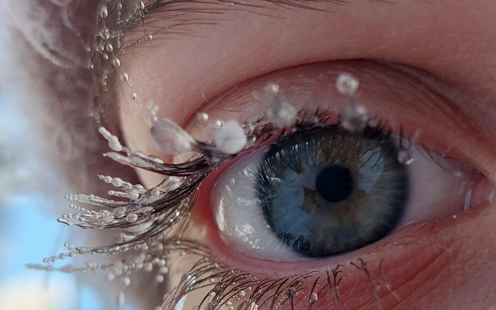 Close-up of a frost-covered eye and frozen lashes — winter UV eye protection guidance from Dr. Roxanna Gangi, Toronto